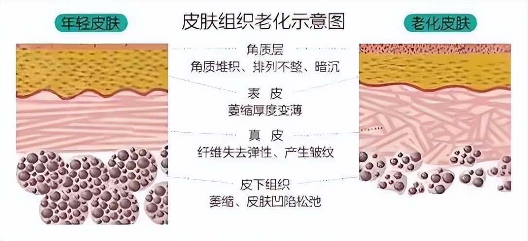 怎样才能让脸上皱纹快速消除？消除面部皱纹的方法