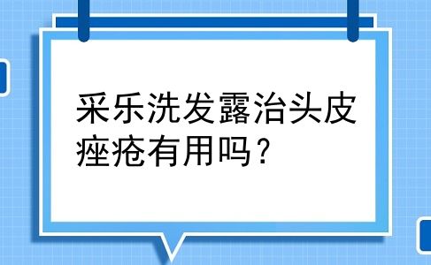 采乐洗发露治头皮痤疮有用吗？