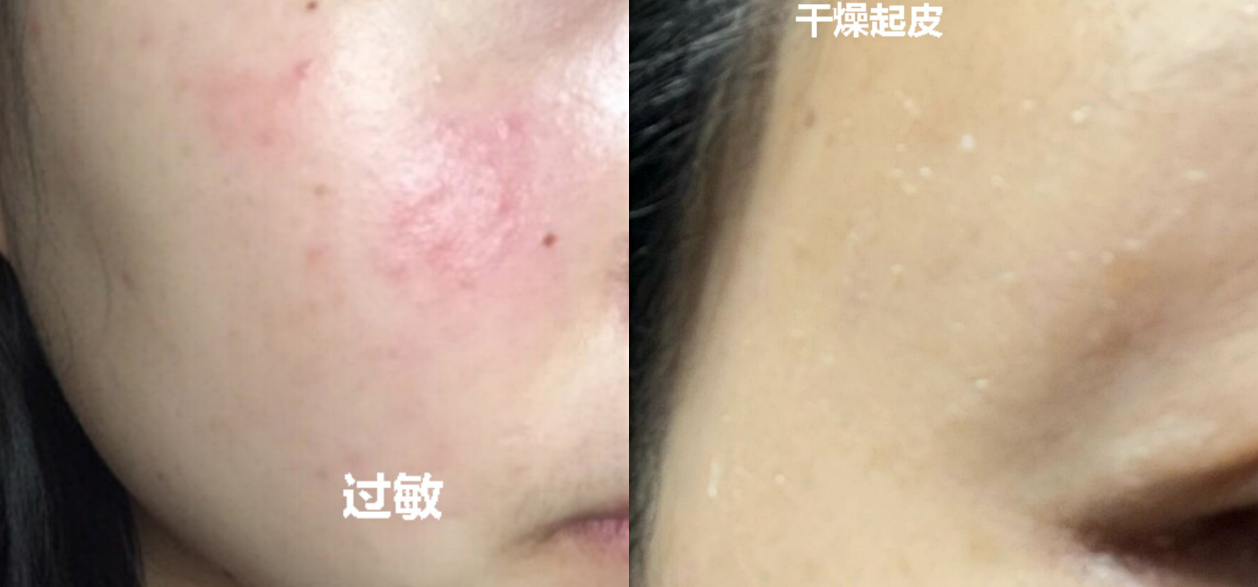 悦木之源和怡丽丝尔水乳哪个好？公认好用的4款孕妇保湿水乳：悦木之源，芙丽丝芳均上榜，你的呢