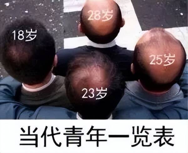 头发一根多少钱（一根头发值25块）