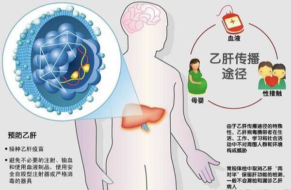 肝功能检查多少钱？查乙肝病毒DNA一般花费多少钱？