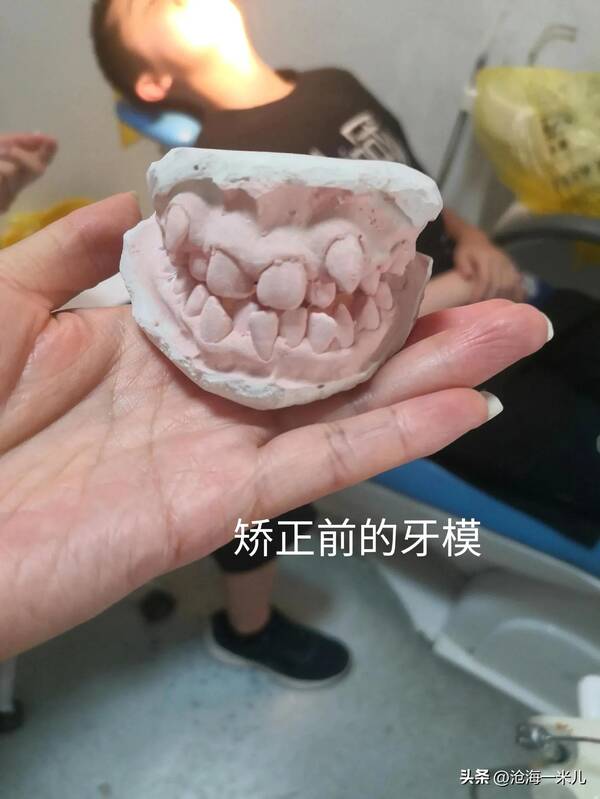 我带着几万块的牙套？花费4000元，戴了2年的牙套，拯救了儿子一口歪七扭八的牙齿