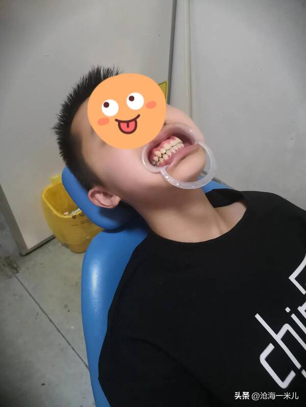 我带着几万块的牙套？花费4000元，戴了2年的牙套，拯救了儿子一口歪七扭八的牙齿