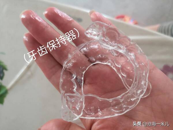 我带着几万块的牙套？花费4000元，戴了2年的牙套，拯救了儿子一口歪七扭八的牙齿
