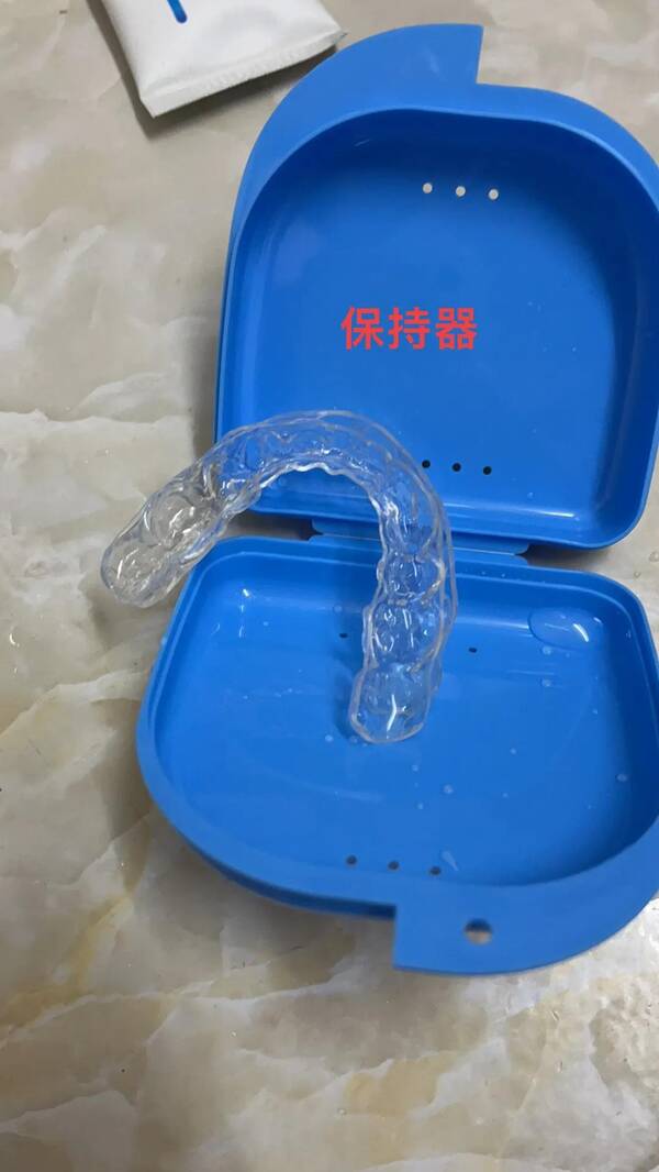 牙套矫正牙齿大概多少钱，牙齿矫正花费了多少钱呢？矫正前后对比