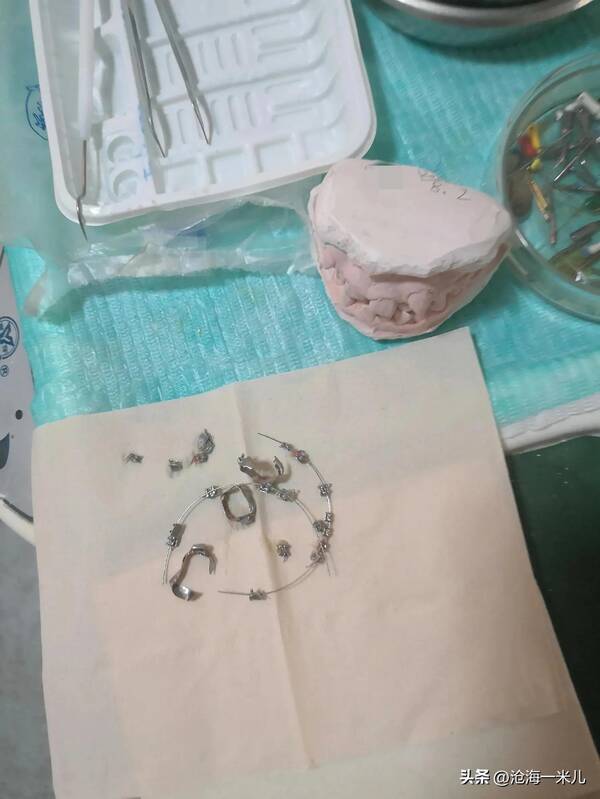 我带着几万块的牙套？花费4000元，戴了2年的牙套，拯救了儿子一口歪七扭八的牙齿