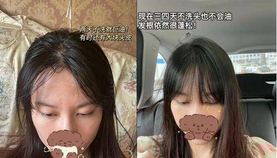 孕妇去屑止痒洗发水哪款好？孕妇适合用哪款洗发水？
