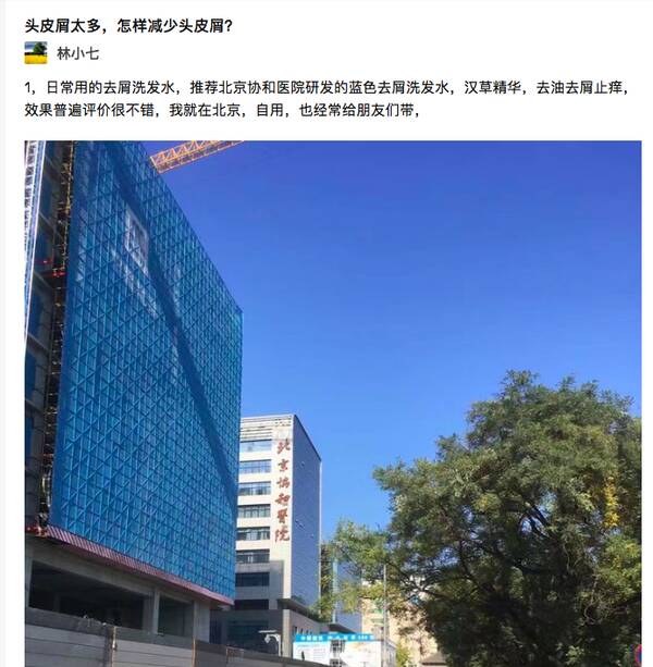 去屑洗发水康王，北京协和医院去屑洗发水怎么样？