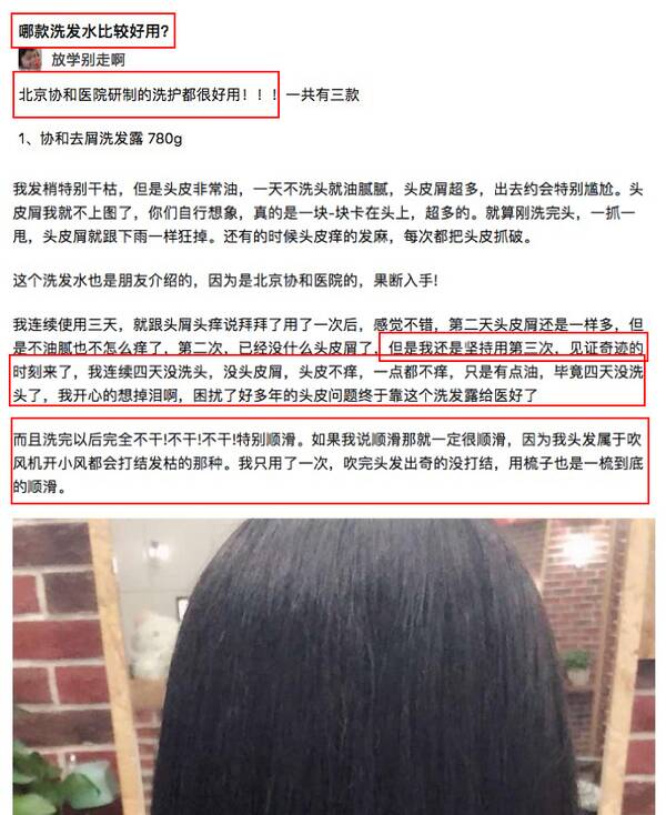 去屑洗发水康王，北京协和医院去屑洗发水怎么样？
