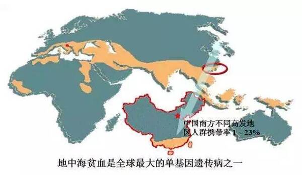 地中海贫血人长相图片，贫血是地中海贫血的一种吗？