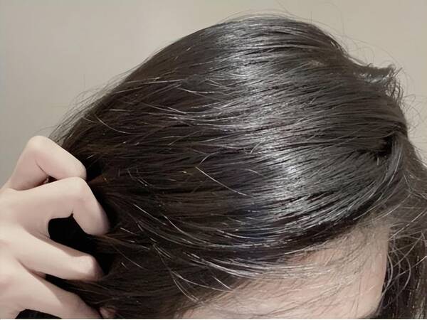 世界防脱发洗发水排名，防脱发洗发水好吗？