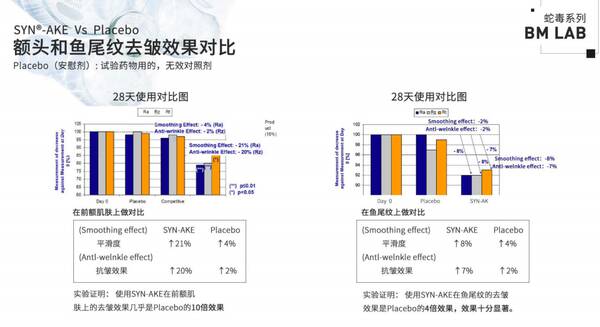 为什么五十岁的女人没有皱纹呢？四五十岁的女人皱纹厉害吗？