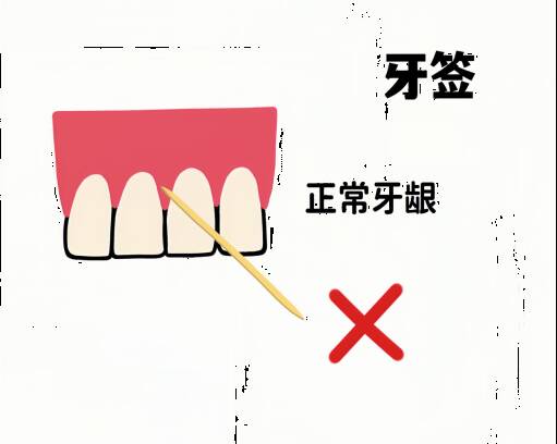 牙菌斑对牙周组织的影响，【口腔健康系列科普】让牙间隙菌斑无处遁形